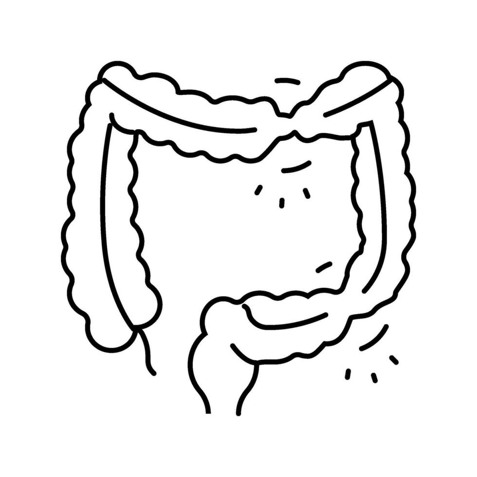 ODS Syndrome